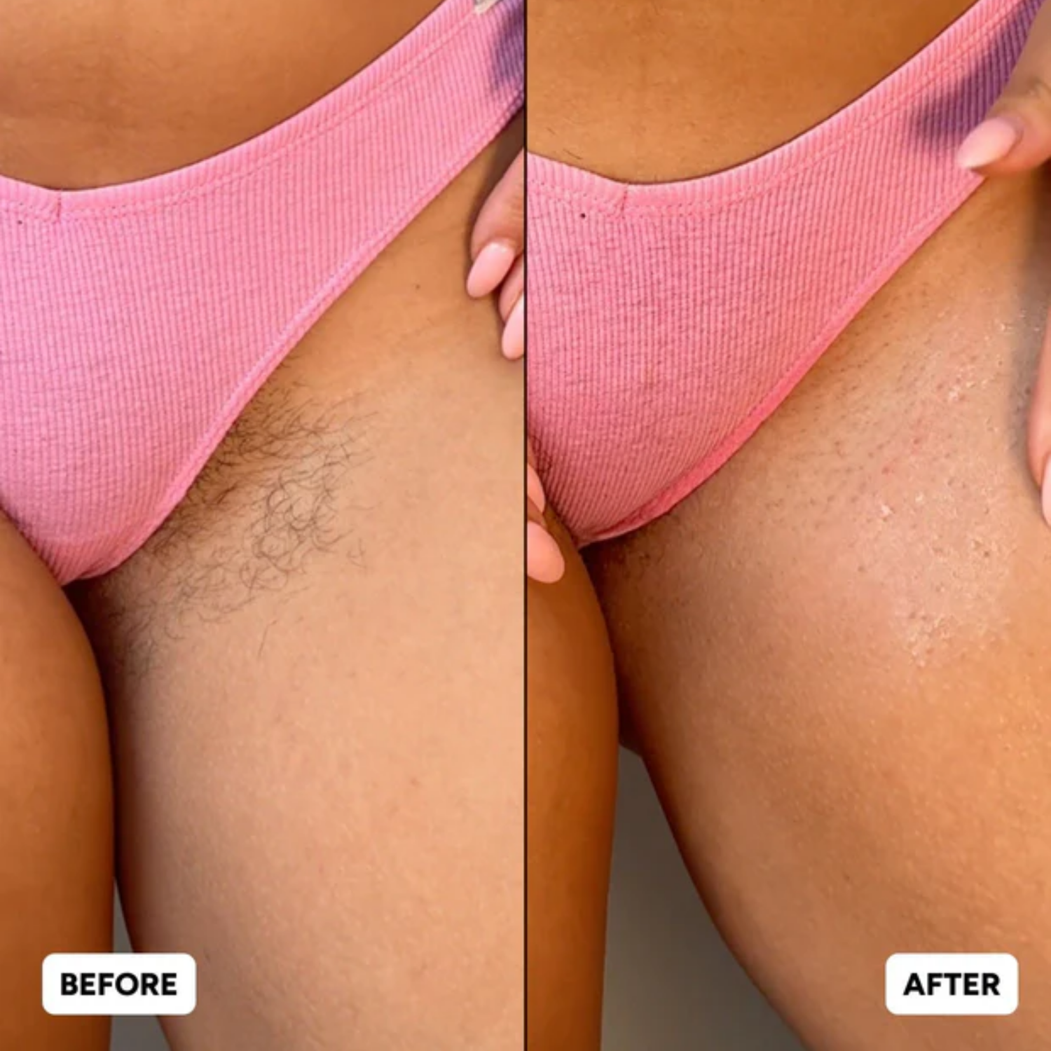 BIKINI REMOVE - HAIR REMOVAL CREAM
